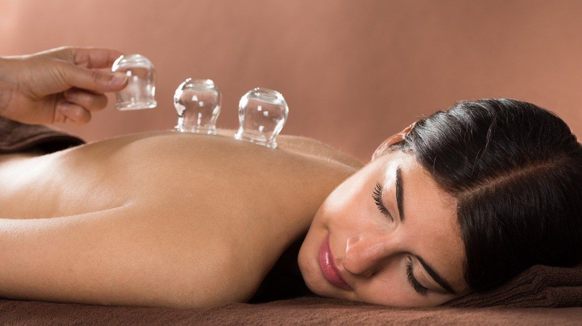 What Are the Benefits of Cupping Treatment?