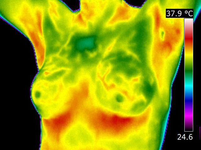 What Can Thermal Imaging Detect?